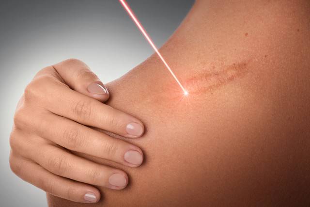 laser-uses-in-treating-skin-problems صورة المقال